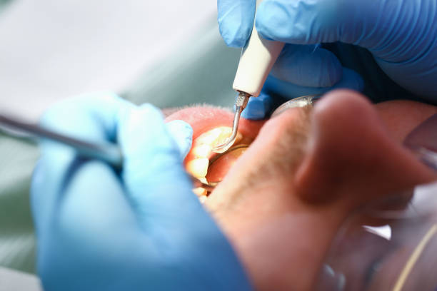 Best Weekend Emergency Dental Services in Georgetown, OH