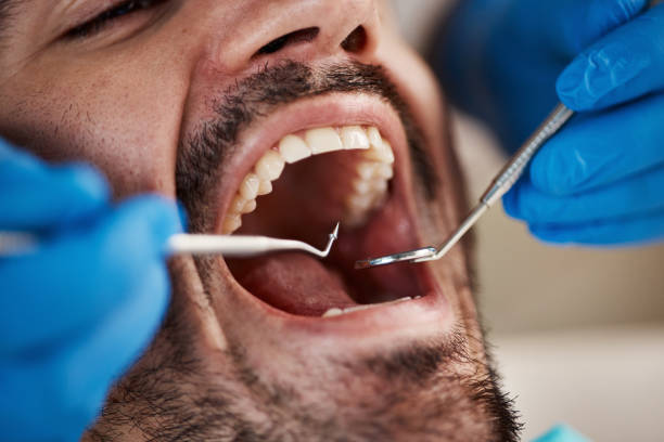 Best Dental Abscess Treatment in Georgetown, OH